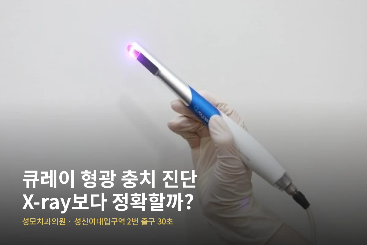 聖母歯科医院で青い光が点いたQraypen